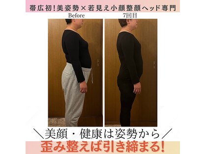ウエルネスエステサロンジョー(Wellness Este Salon JO)の写真