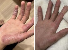 ココネイル(coco.nail)/