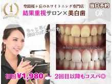 ホワイトニングショップ 多摩店