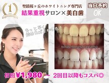 ホワイトニングショップ 多摩店