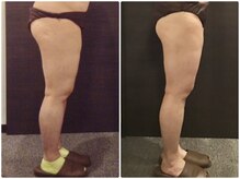 ウェリナ平和堂長久手院/小顔矯正/骨盤矯正/痩身/整体