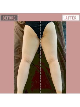 マーリエ(Malie)/【ラフォス】速攻脚スラリ