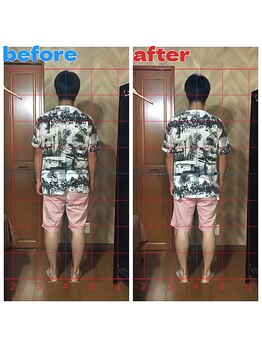 春日部コアラ整体院/Before→After(姿勢)後面