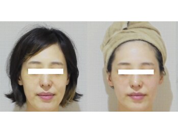 アルマ 芦屋(ALMA)/梅雨で下がるテンションの底上げ