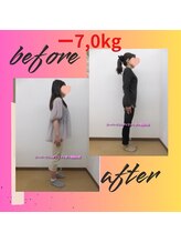 スーパースリムダイエット茅ヶ崎 茅ヶ崎整体院/3ヵ月－7,0ｋｇ減ダイエット♪
