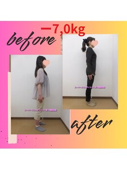 スーパースリムダイエット茅ヶ崎 茅ヶ崎整体院/3ヵ月－7,0ｋｇ減ダイエット♪