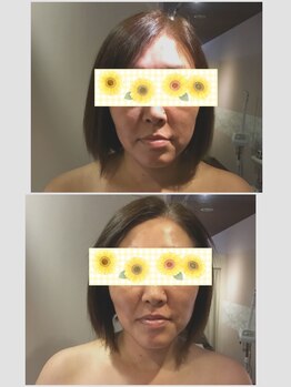 ロゼッティ(ROSETTY)/韓国コルギ☆骨筋小顔☆