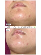 リベル(ReBelle.)/