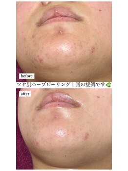 リベル(ReBelle.)/