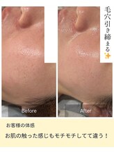 フワリ(FUWARI)/陶肌トリートメント・陶肌ピール