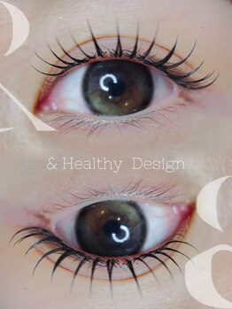 ウララ(uraura)/&healthy