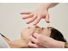 ハリナチュレ 大宮マルイ店/エラ張り特化美容鍼