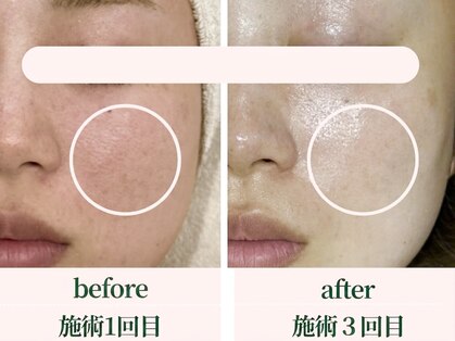サロン アンジュ(salon.anju)の写真