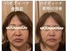 【期間限定水素パック付】人気No.1水素まみれスピード痩せコース8,800円