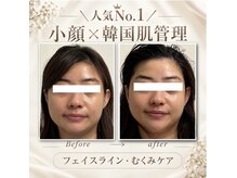 シーズ(C'ies)の雰囲気（小顔リフトでフェイスラインすっきり,むくみ・たるみケア二重顎）