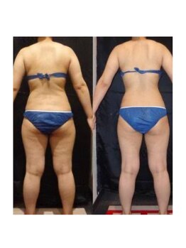 ルノン(lunon)/セル撃退!薄着でも安心。