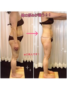 ボディエステティック アクアオーラ 富山店/別人級！