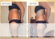 キレイサローネ 表参道店(KIREI SALONE)