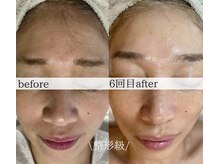 エクレ(eclat)/圧巻のエイジングケア