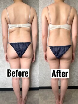 ノート(Naught)/大好評☆育乳バストケアメニュー