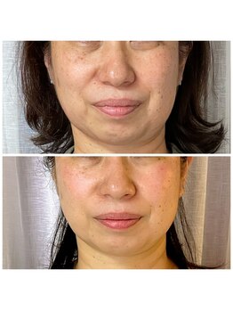 ココオーブ(COCO AUBE)/韓国で大人気レモンボトル