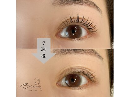 ビコ(Bico)の写真