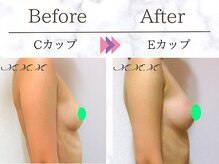 エムエムエム 表参道Luxeサロン(M.M.M)/【バストアップ例】　C→Eカップ