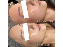 ナーズ(NAZ)の雰囲気（リピート率No.1★ララピールの効果は間違いなし）