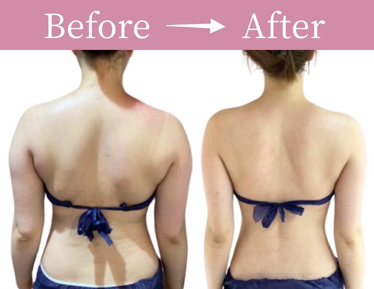 じぶんdeエステ 池袋店｜ホットペッパービューティー