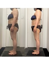 テラピ 藤江店/ウエスト・ヒップ・脚全身痩せ◎