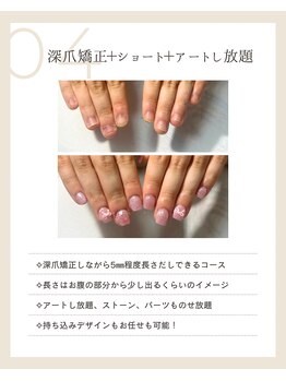 ピノ(pino)/◆深爪矯正＋ショート＋アート◆