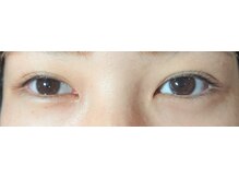 プレステージ 白金台(Prestige)/何もつけていない状態になります