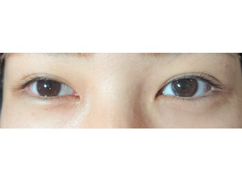 プレステージ 白金台(Prestige)/何もつけていない状態になります