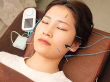 ハリファ鍼灸院 覚王山院(HariFa鍼灸院)/美容鍼とセットもオススメ