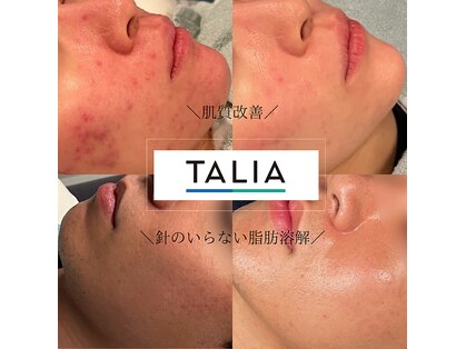 タリア(TALIA)の写真