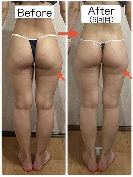 リアン(Liam)/浮腫スッキリ/美尻美脚