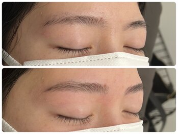 プラネット 池袋東口店の写真/プロの力で効果を実感！気になる毛穴やニキビ肌を徹底ケア◎土台を整えてゆるがない美しい肌へ導きます☆