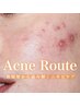 《原因追求》Acne Route ＿肌履歴から読み解くニキビケア ¥16500