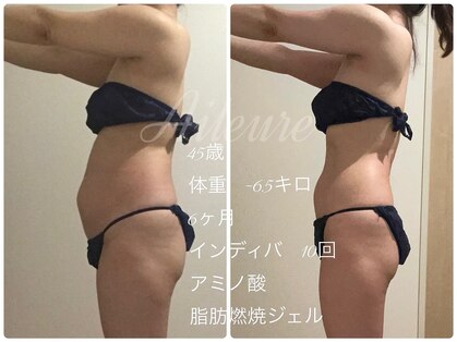 エルール トータルビューティ(Aileure total beauty)の写真