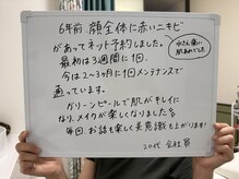 トリートメントルーム フェリーチェ(Felice)/お客様の声「敏感・ニキビ」
