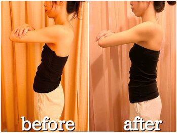 癒楽/骨格からの調整で姿勢改善