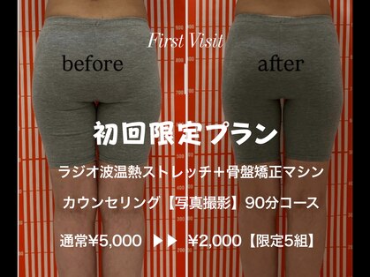 ビジリンヌの写真
