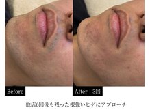 ダイヤ 名古屋中川区店(Daiya)/【他店で減らなかった実例】3回