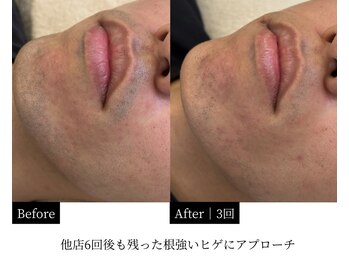 ダイヤ 名古屋中川区店(Daiya)/【他店で減らなかった実例】3回