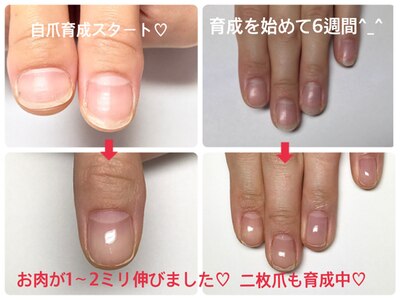 自爪育成でコンプレックスのあるお爪から見せたくなる指先へ♪