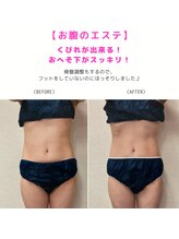  ジュエル(JEWEL)/ウエストにくびれができる！