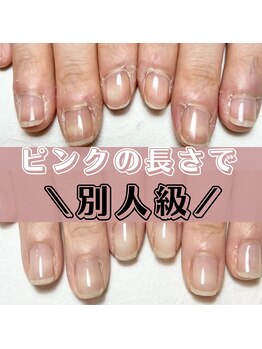 エルアンド(elle＆)/爪のピンクが伸びない悩み