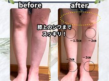 サロン レフィーノ(Salon Refino)/足つぼトリートメント検証結果