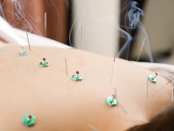 ビーハリット(B-HariT)/必要に応じて鍼灸同時施術