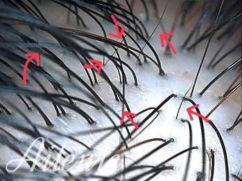 エルール トータルビューティ(Aileure total beauty)/育毛促進ケア